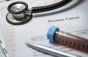 Read more about the article Prostate cancer: How long should hormonal therapy last?